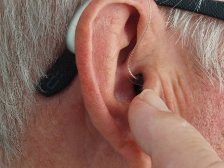 О чем сигналят волосы в ушах: это предупреждение