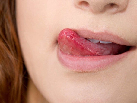 Рак уже в теле: подскажет это чувство во рту