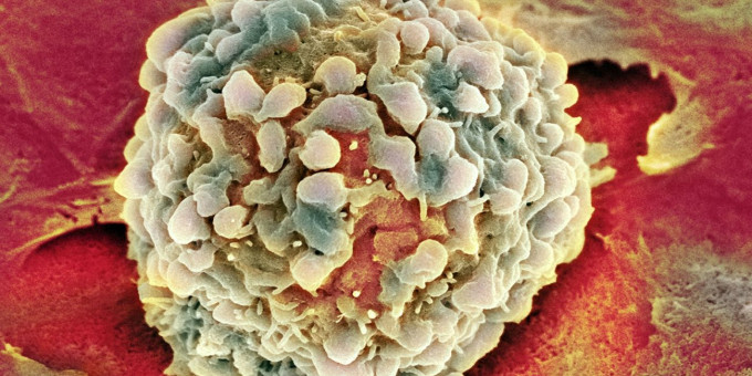 Назван главный способ уберечься от рака